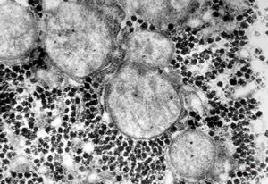 M,2y. | normal hepatocyte M,2y. | normal hepatocyte